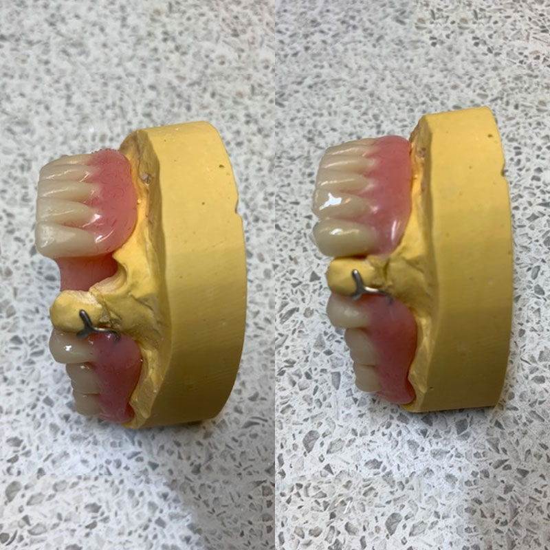 Additions from The Denture Clinic, Canterbury